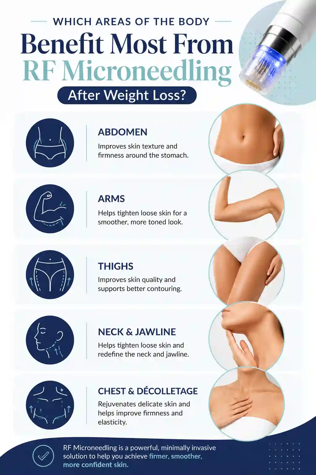 Which Areas of the Body Benefit Most From RF Microneedling After Weight Loss Swindon